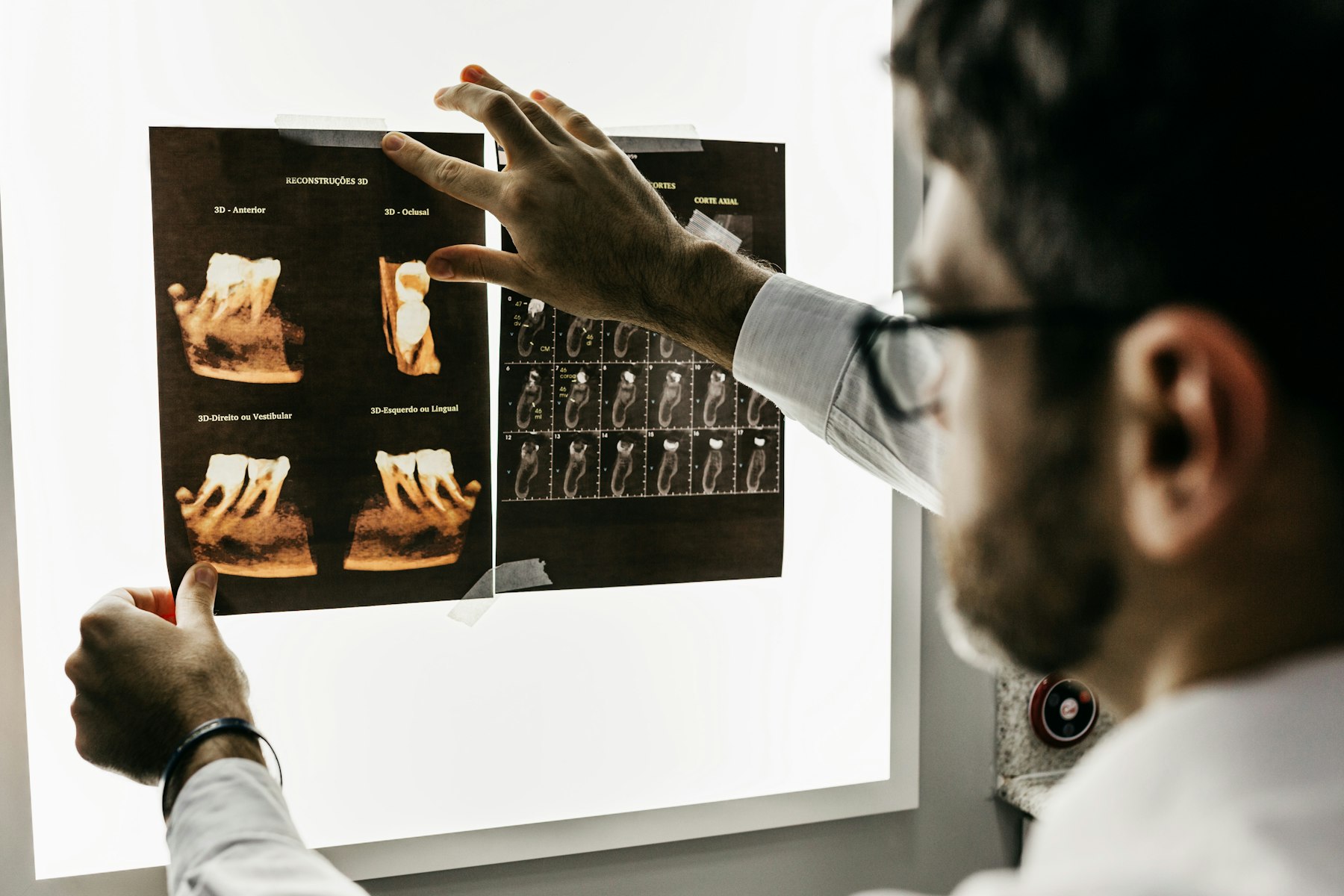 A dentist reading tooth scans on a lightbox